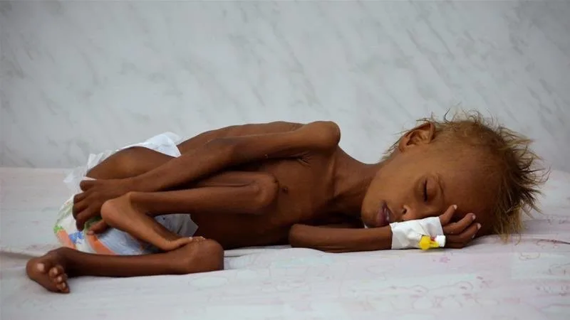 UNICEF says one child dies every 10 minutes in Yemen | X (@AR_Salimii)