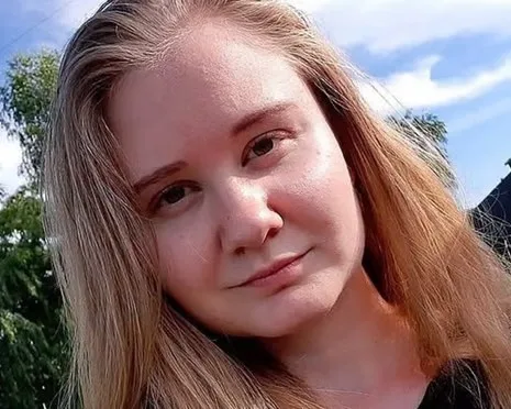 The 28-year-old worked at a Siberian anti-plague research institute and died after developing what authorities call “pneumonia of unknown etiology.” | X (@MarioNawfal)