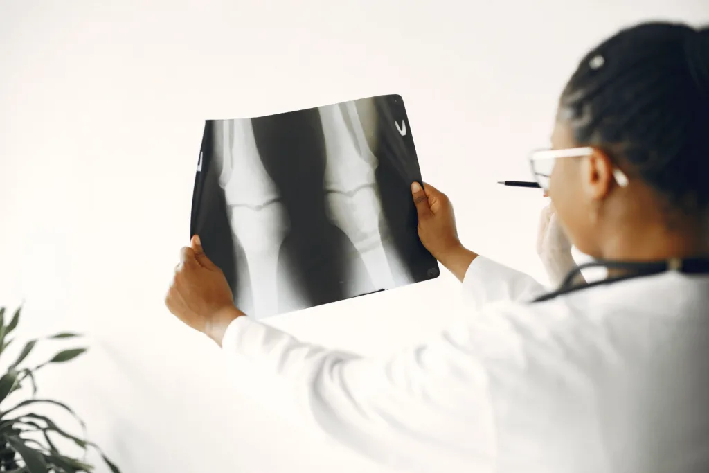 Doctors warn childhood habits could raise future osteoporosis risk